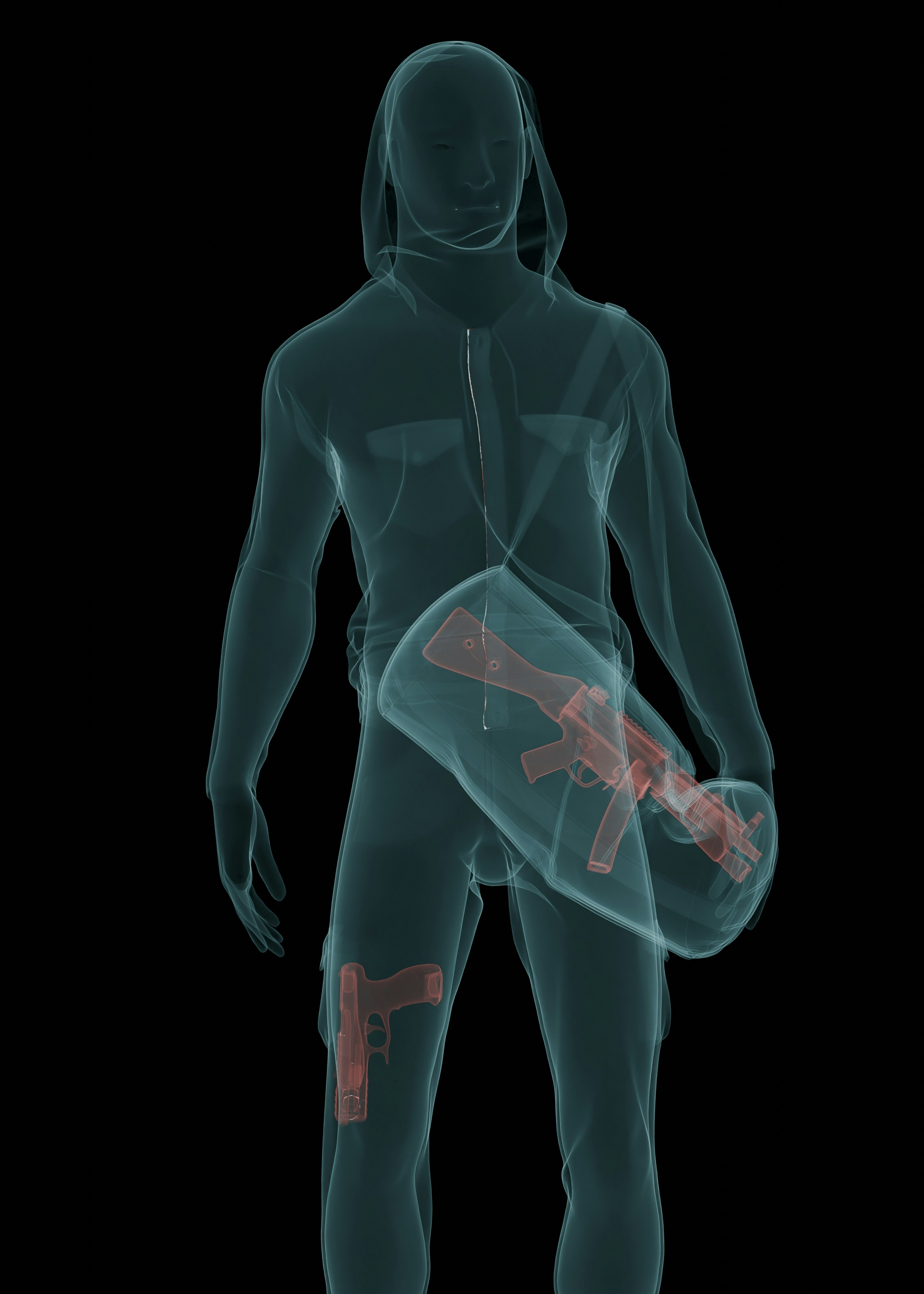 Análisis de la marcha Dinámica y Rehabilitación predictiva a través de Modelado Biomecánico impulsado por IA