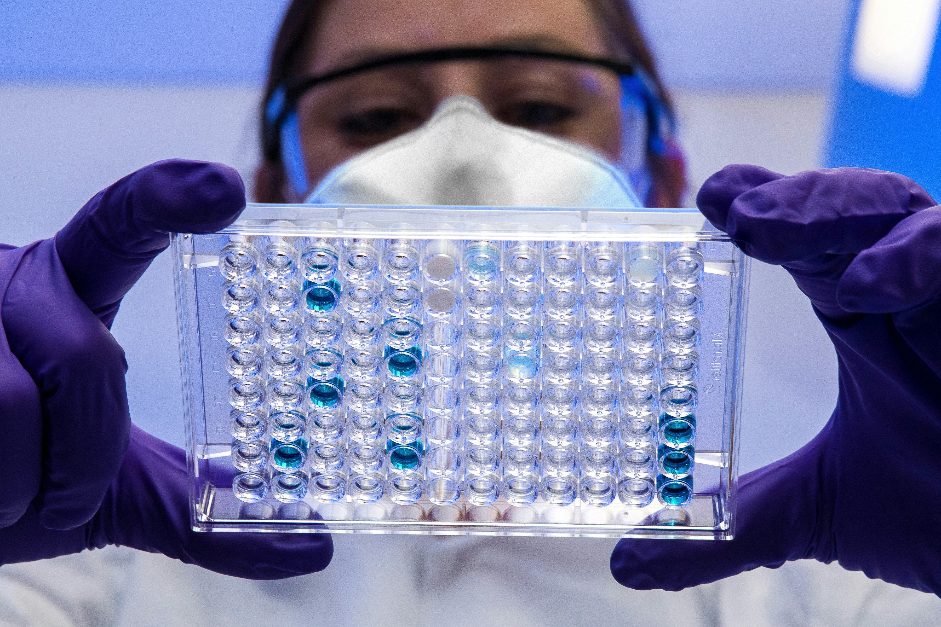 Análisis SAXS con aprendizaje automático diferenciable para nanopartículas lipídicas