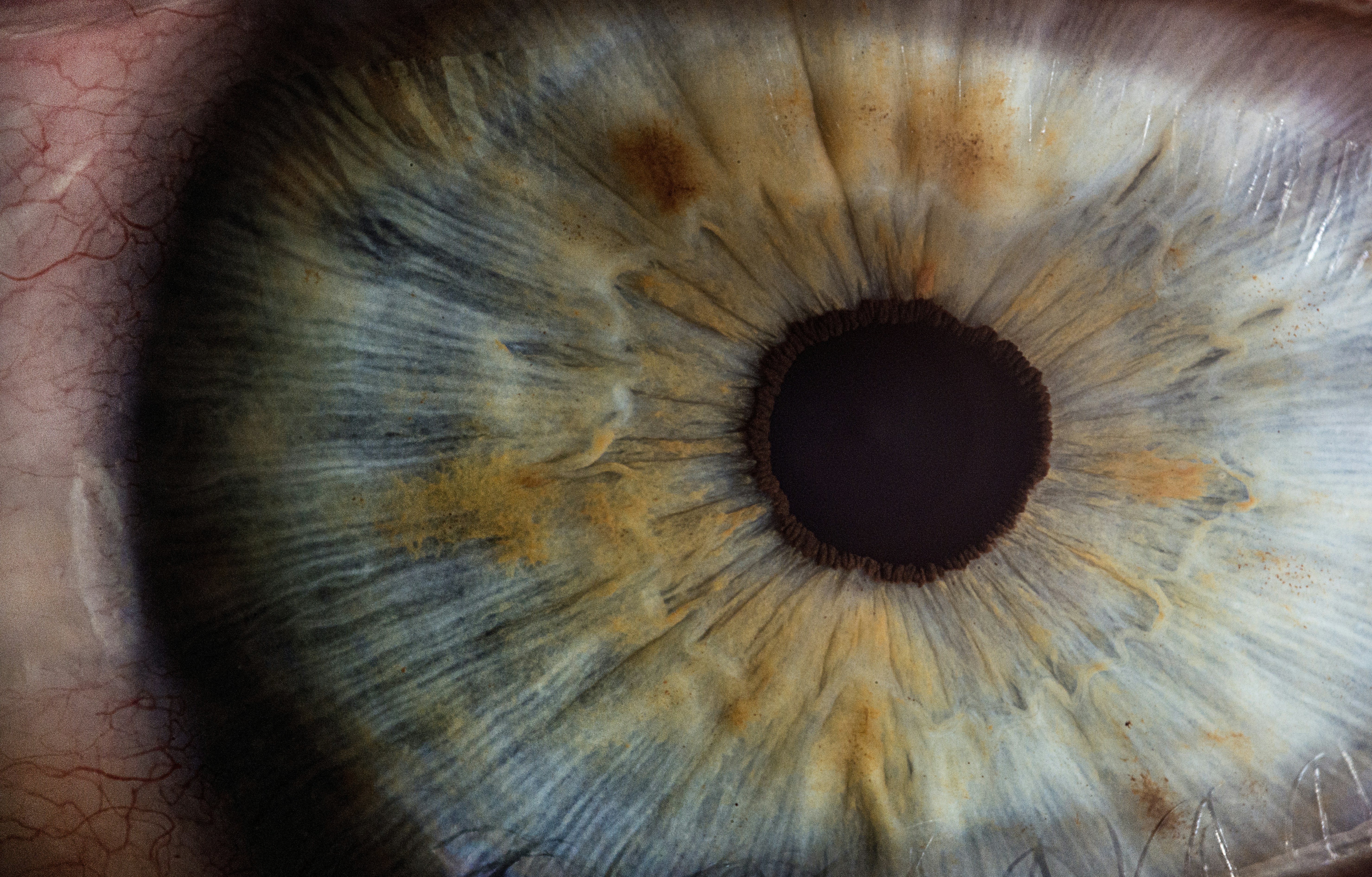 Aprendiendo a ver con implantes epirretinianos y aprendizaje por refuerzo