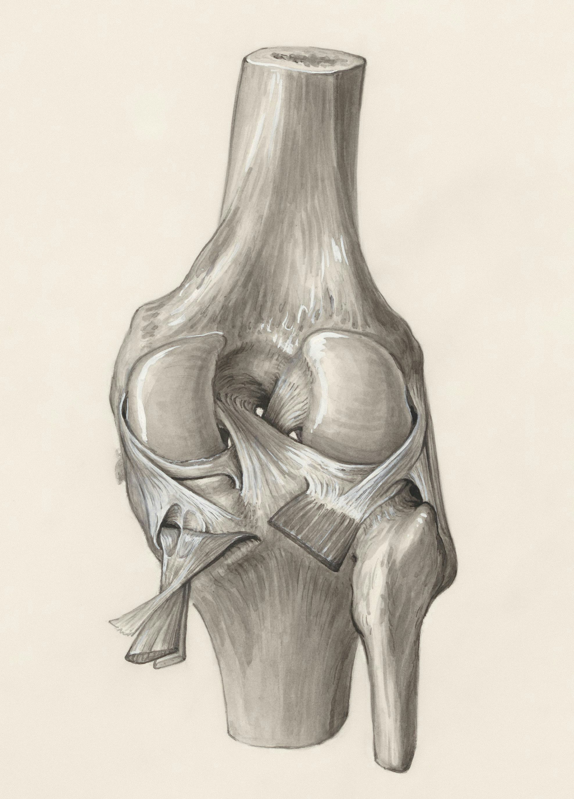Clasificación de la gravedad de la osteoartritis de rodilla mediante aprendizaje profundo optimizado e IA inteligente impulsada por LLM en sistemas con limitaciones computacionales