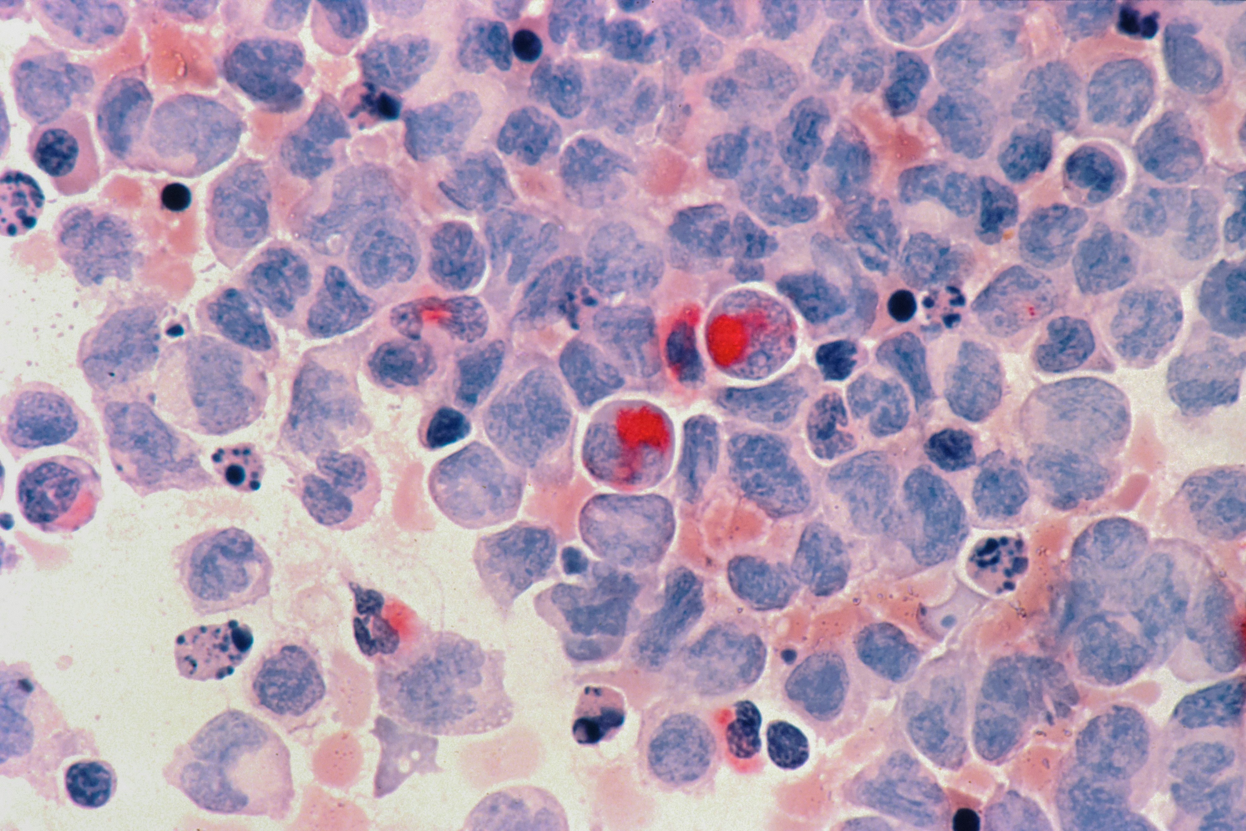 Un Criterio de Ordenamiento Topológico para Grafos Acíclicos Dirigidos Causales Aleatorios