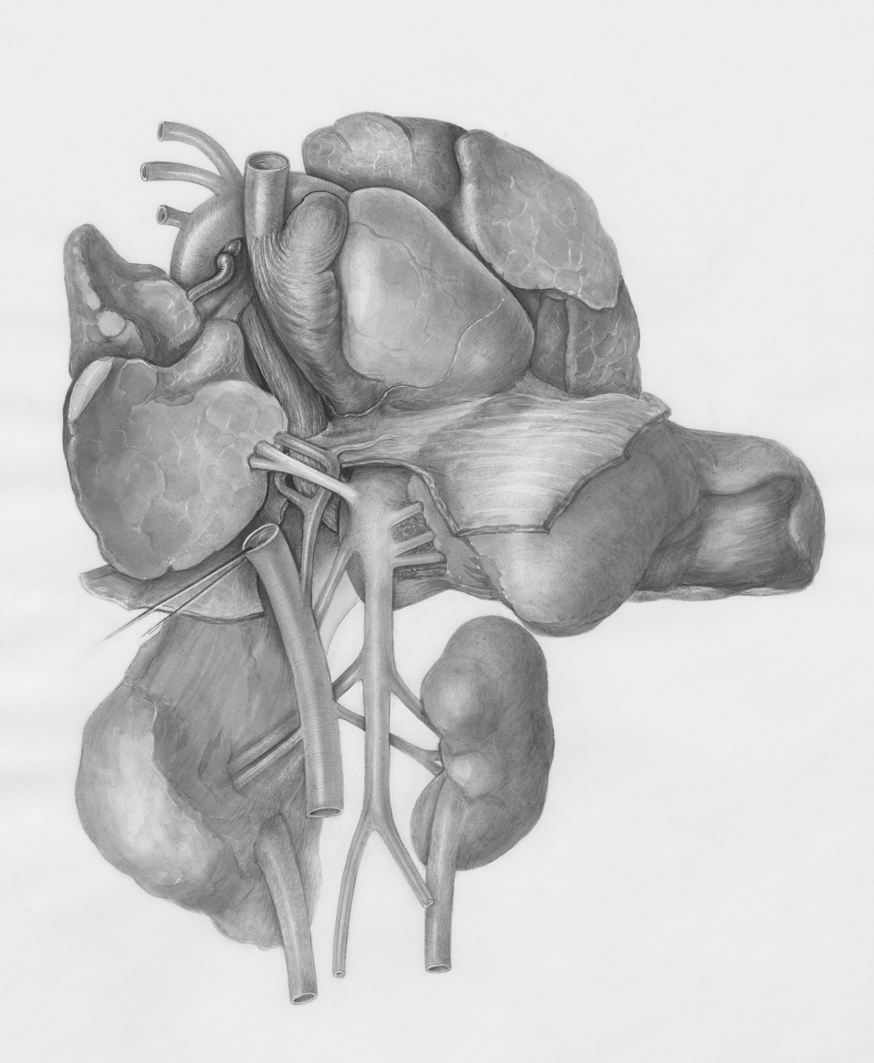 Difusión Desenredada de Anatomía-Enfermedad (DADD) para la Síntesis Controlable de la Progresión de la Colitis Ulcerosa