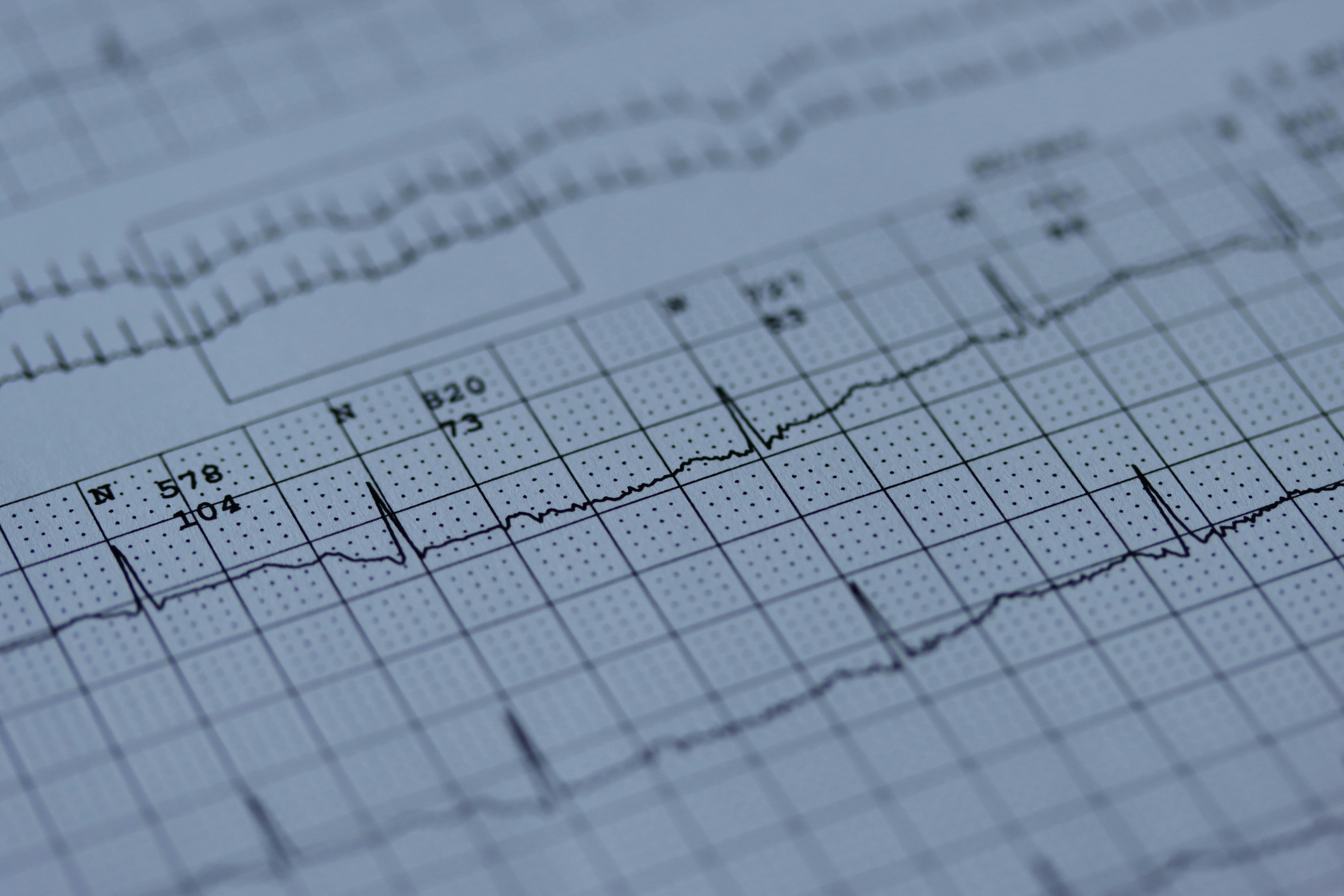 Deep learning como sustituto escalable de modelos físicos en electrocardiología