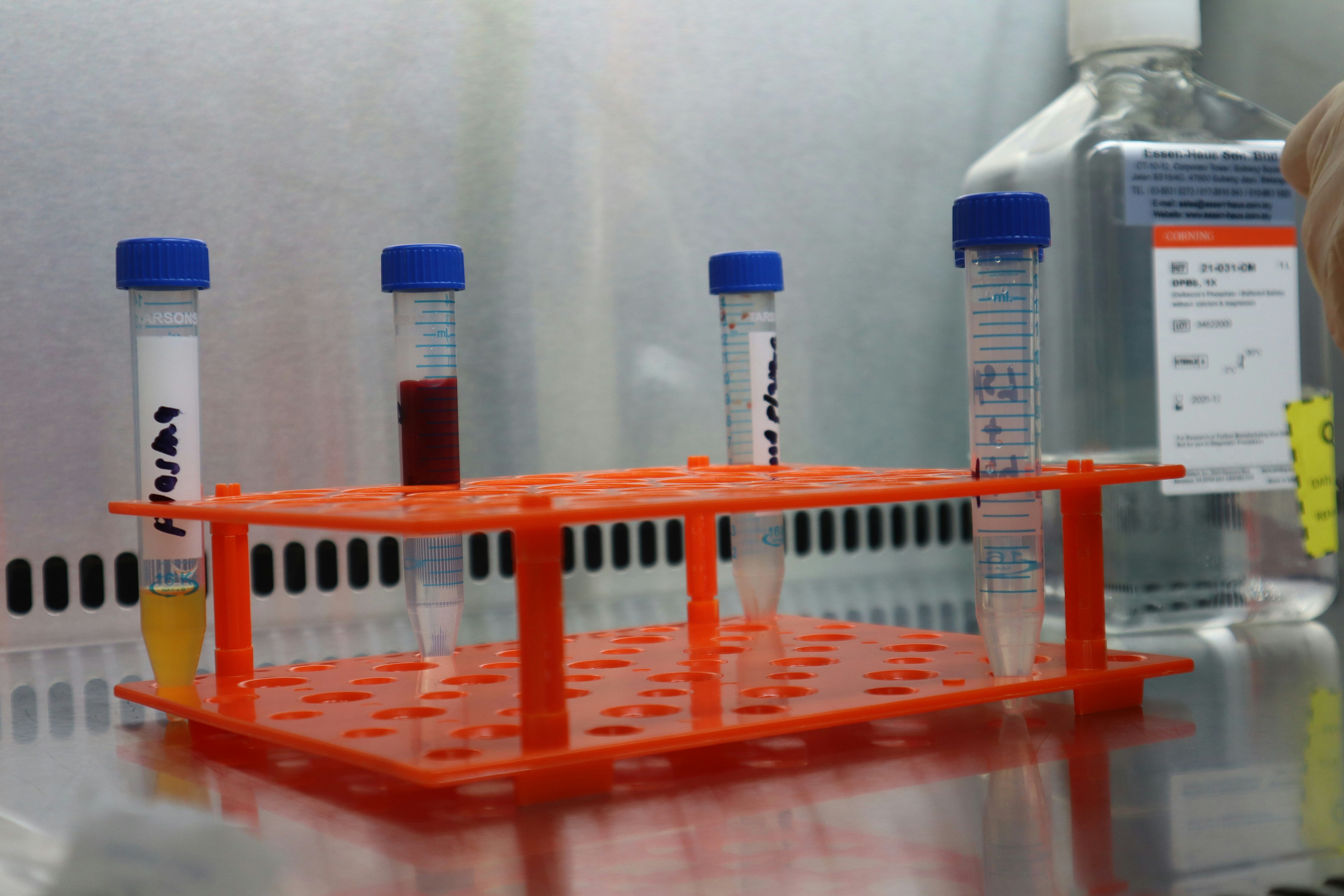 Detección de anomalías de pocas muestras sin entrenamiento a través de modelado de subespacios