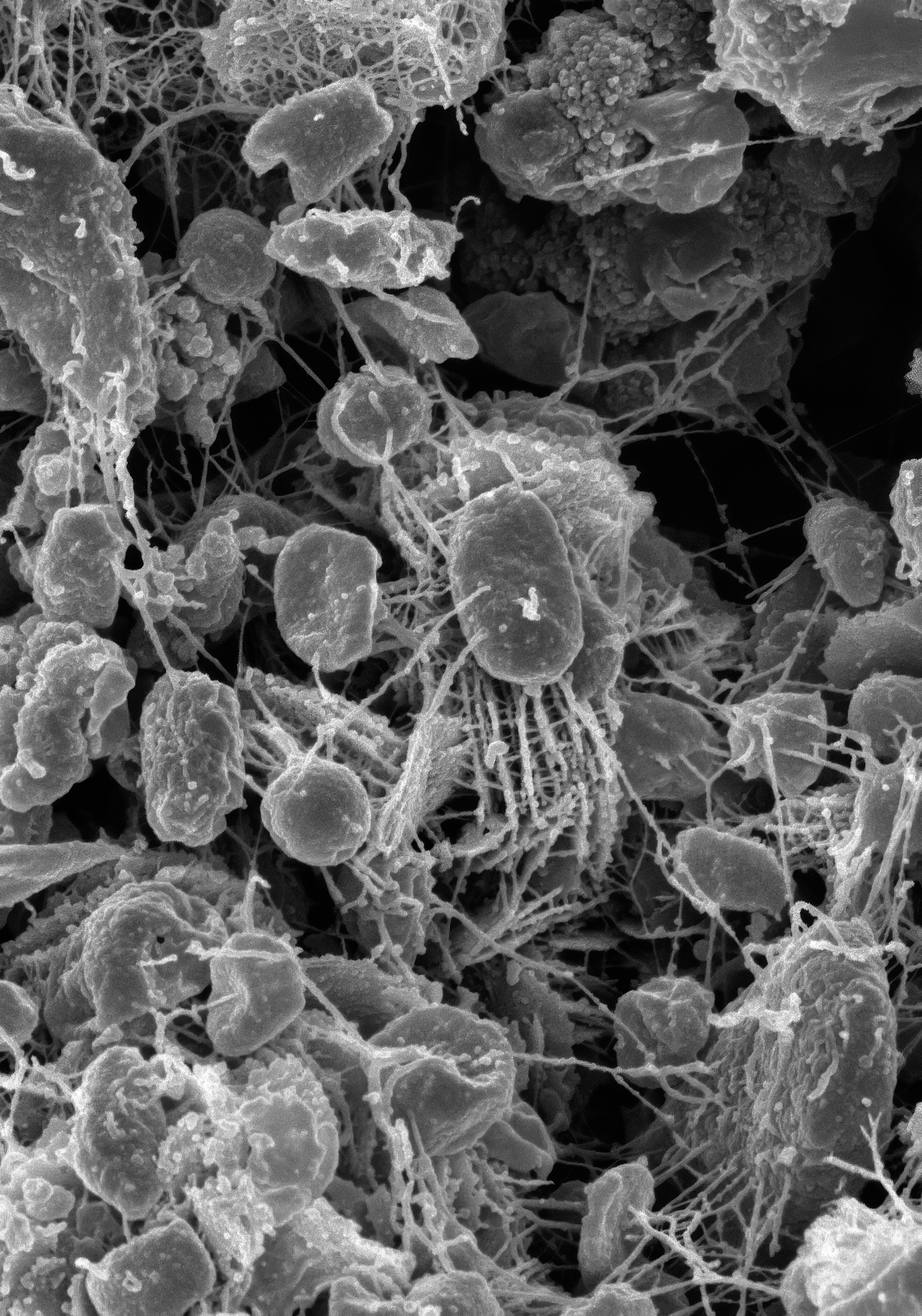 Patrones principales de microservicios