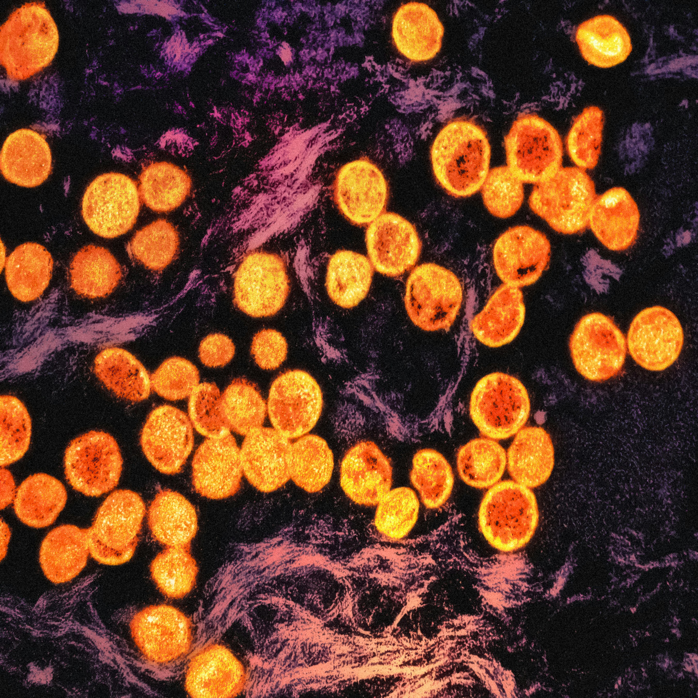 Cuidado con las rarezas: ¿Pueden las enfermedades cutáneas raras ser diagnosticadas de manera confiable mediante el razonamiento diagnóstico?