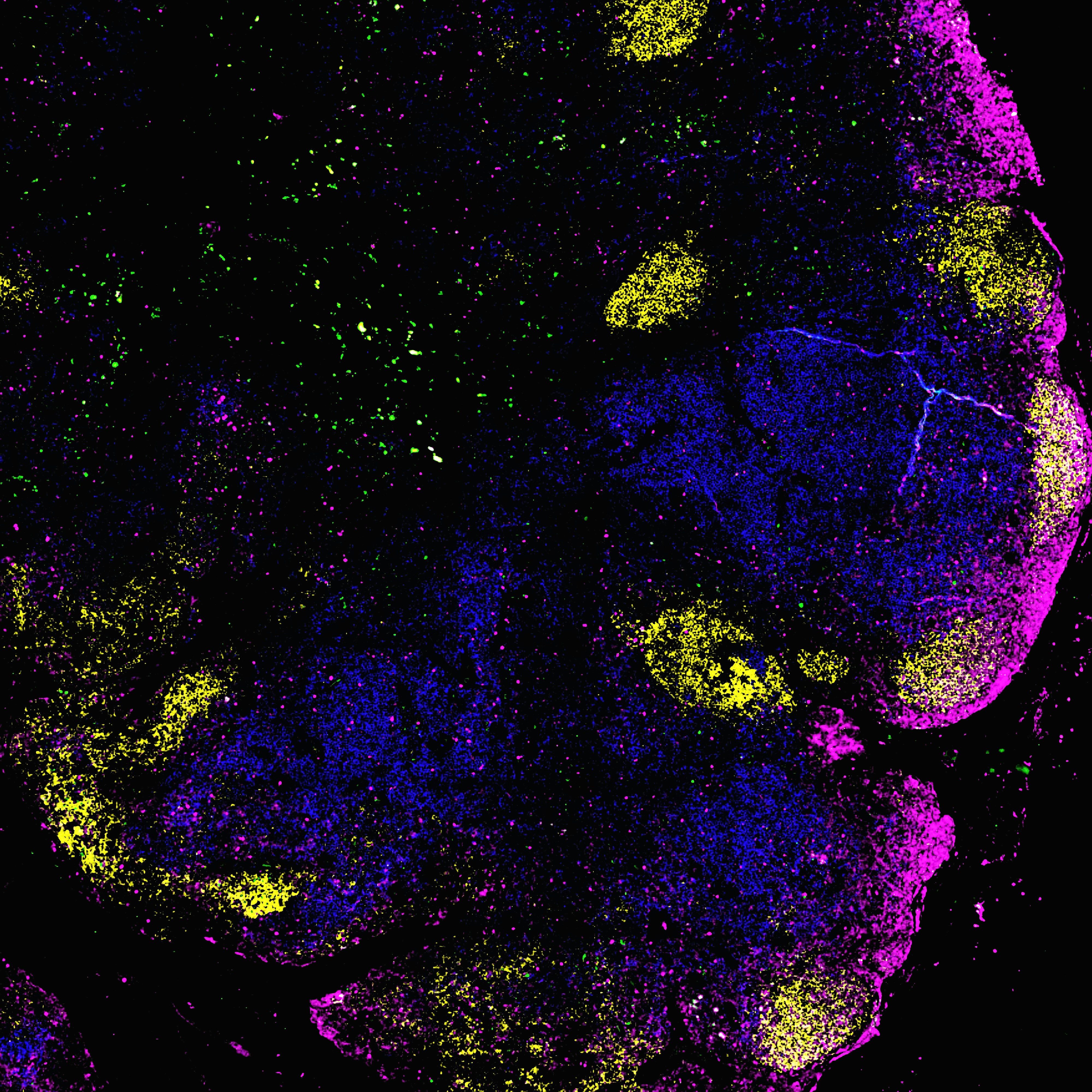 Estimación posterior neuronal de parámetros del terreno a partir de datos de sondeo radar
