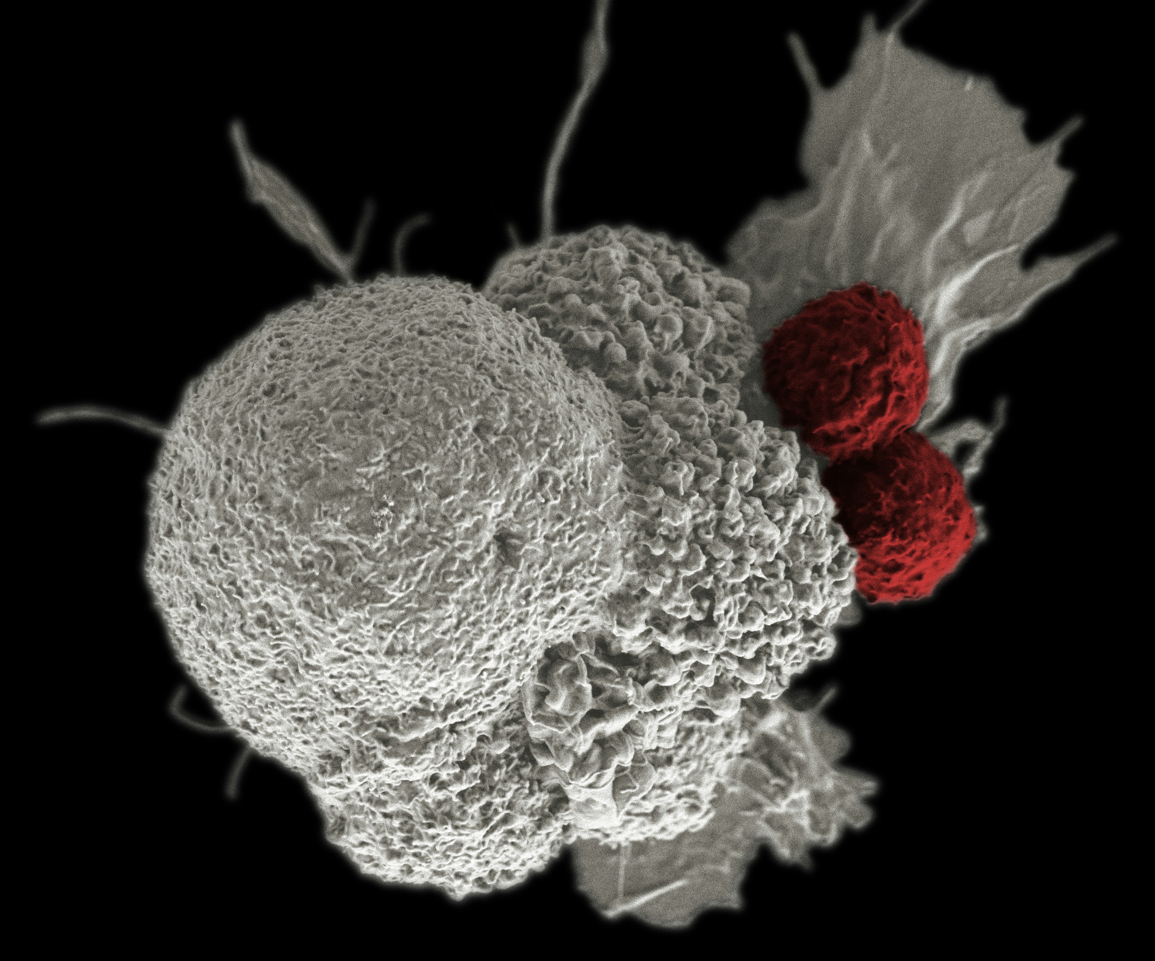 Evaluación sistemática de modelos fundacionales para análisis multimodal de cáncer