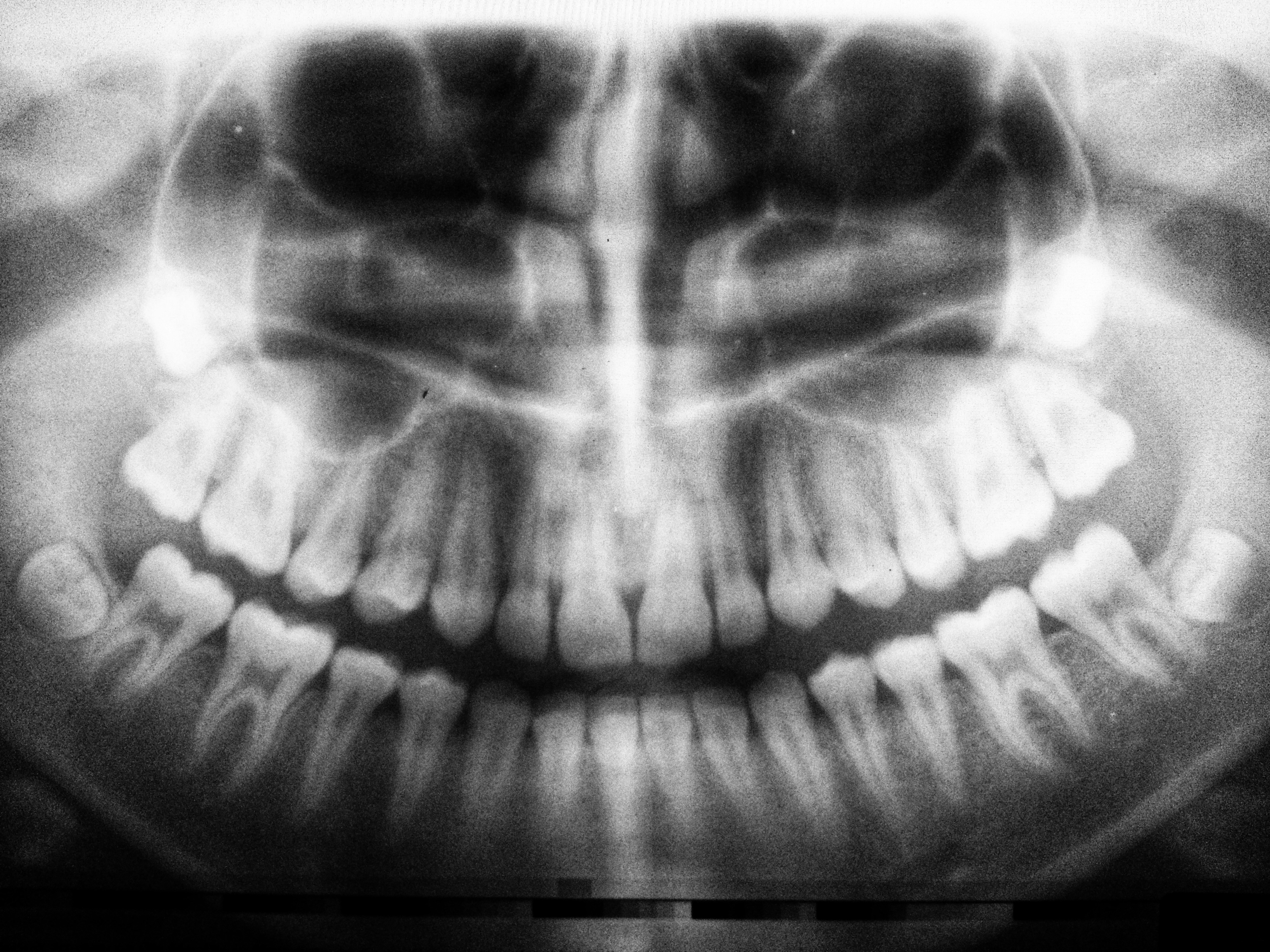La planitud y la alineación de gradientes son ambas necesarias: Exploración alineada con gradientes consciente del espectro para el aprendizaje de múltiples distribuciones