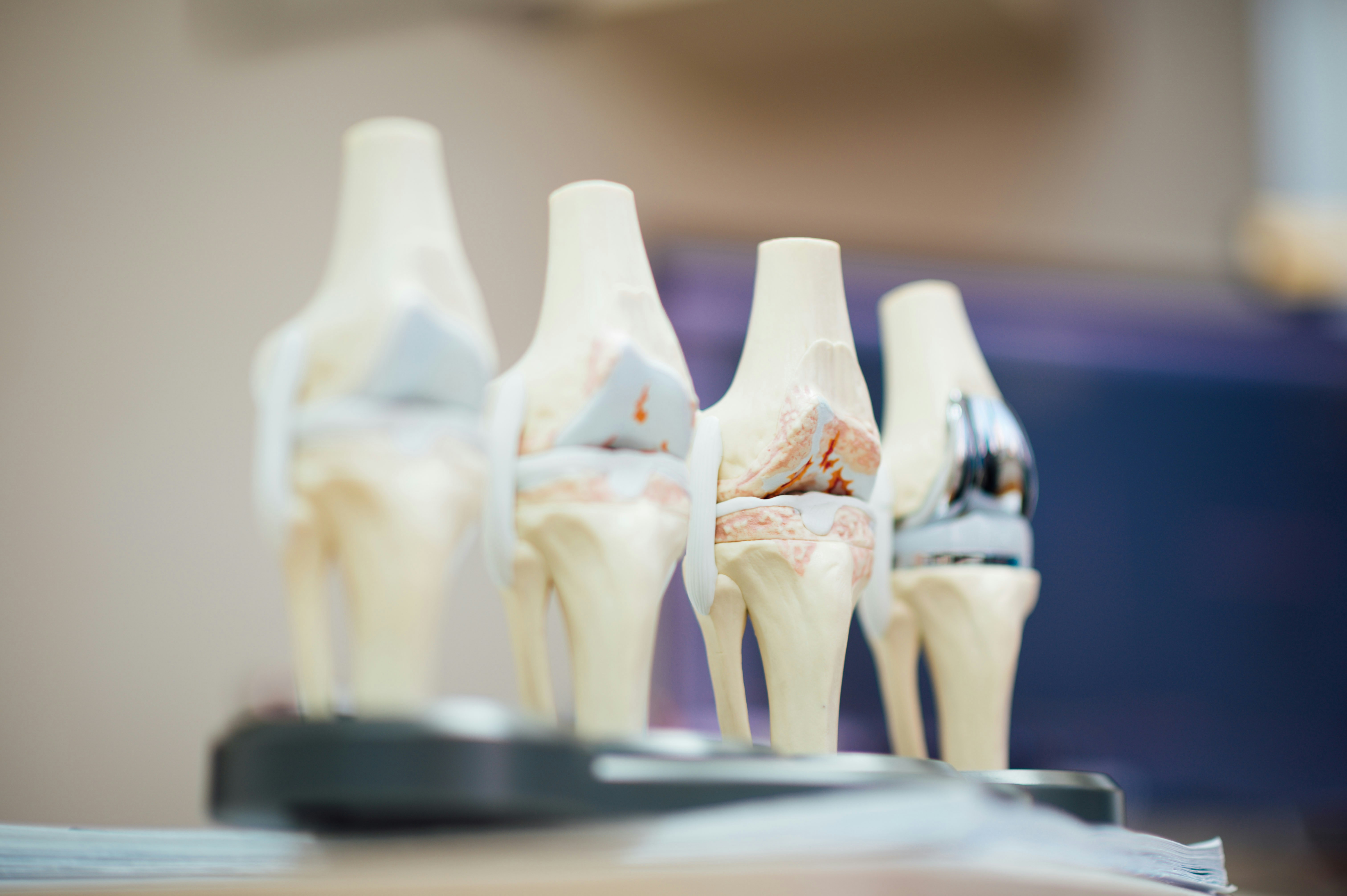 IA interpretable para estudios de osteoartritis de rodilla