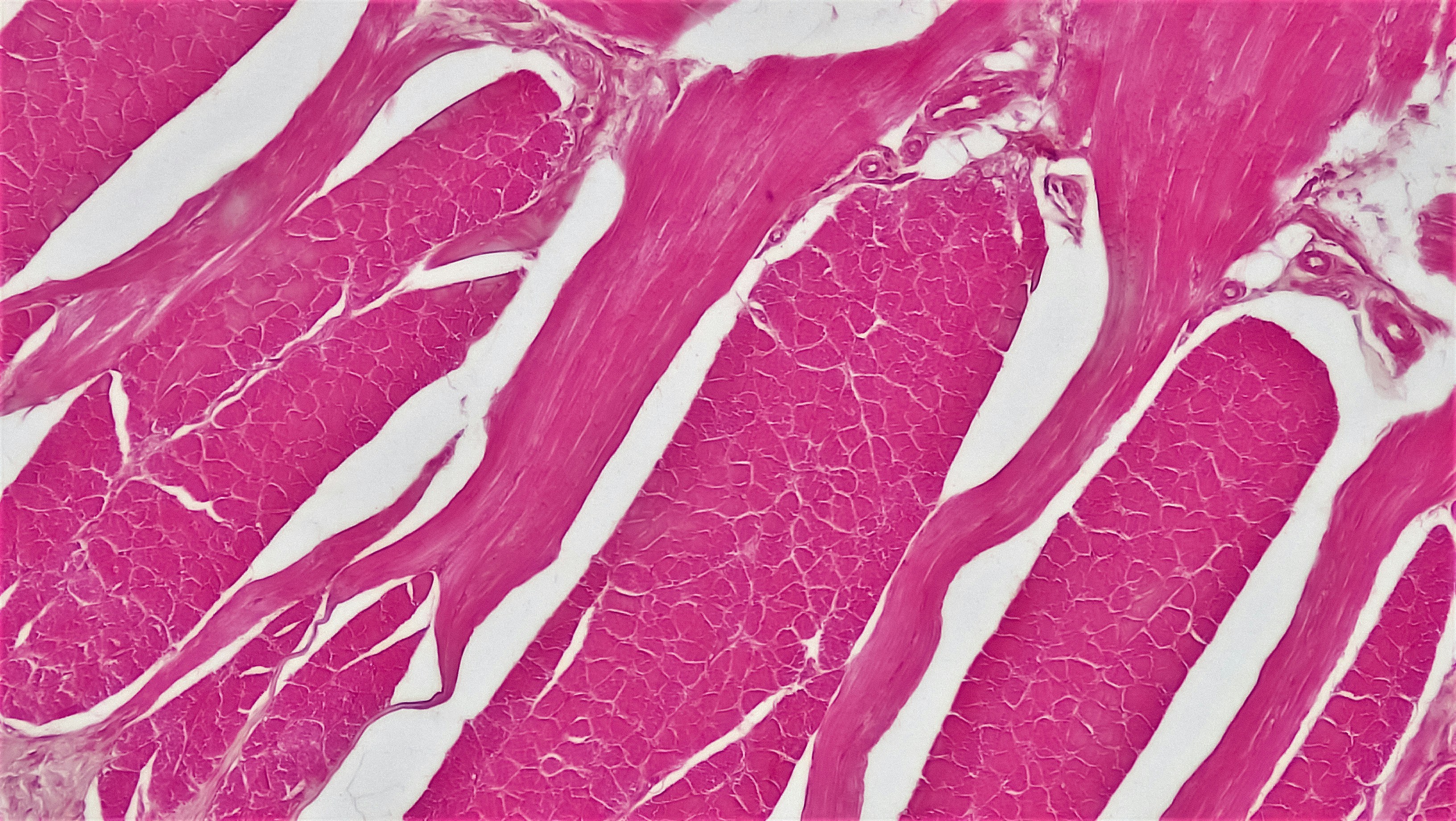 Inferencia Variacional para EDEs Impulsadas por Procesos de Lévy mediante Inclinación Neuronal