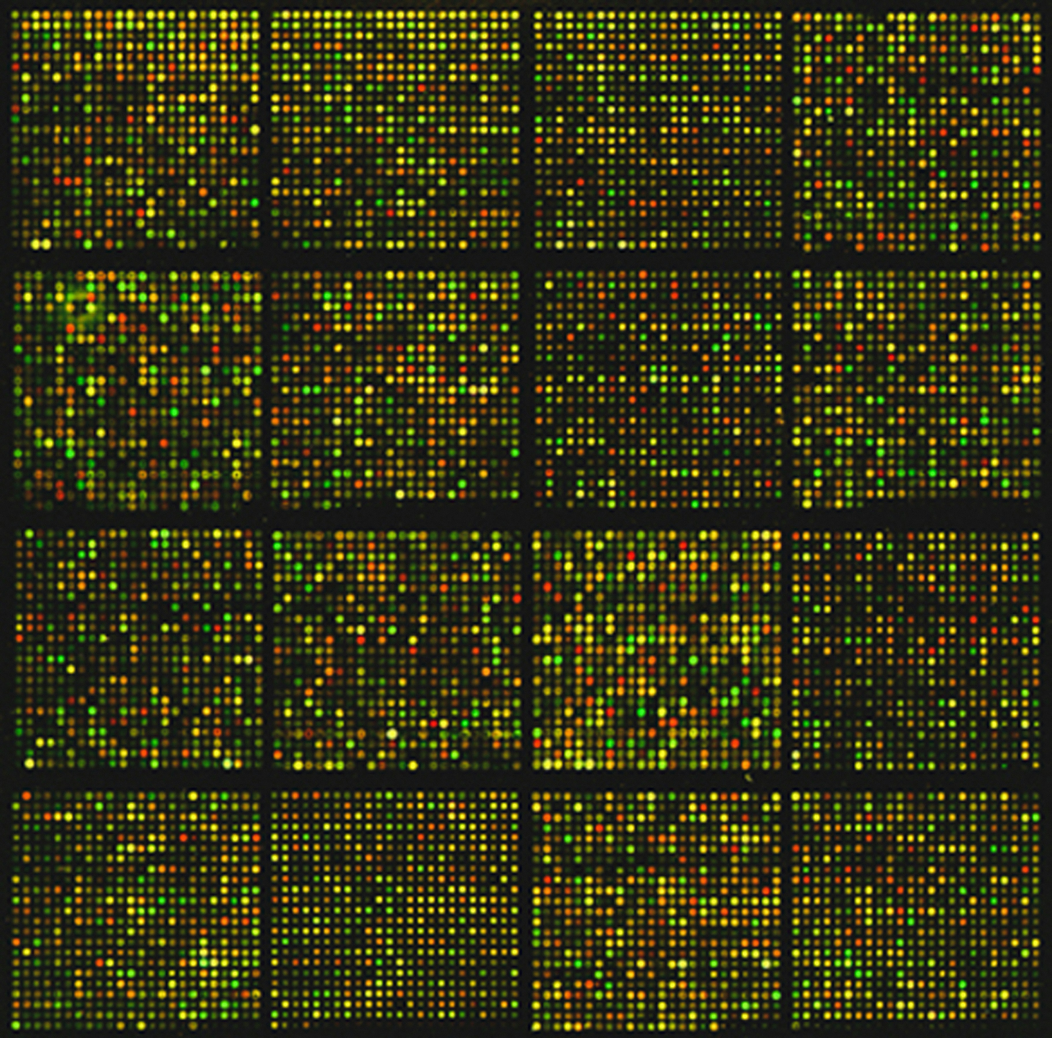 Segmentación semántica en tiempo real de lesiones metastásicas mediante análisis de mezcla espectral adaptativa