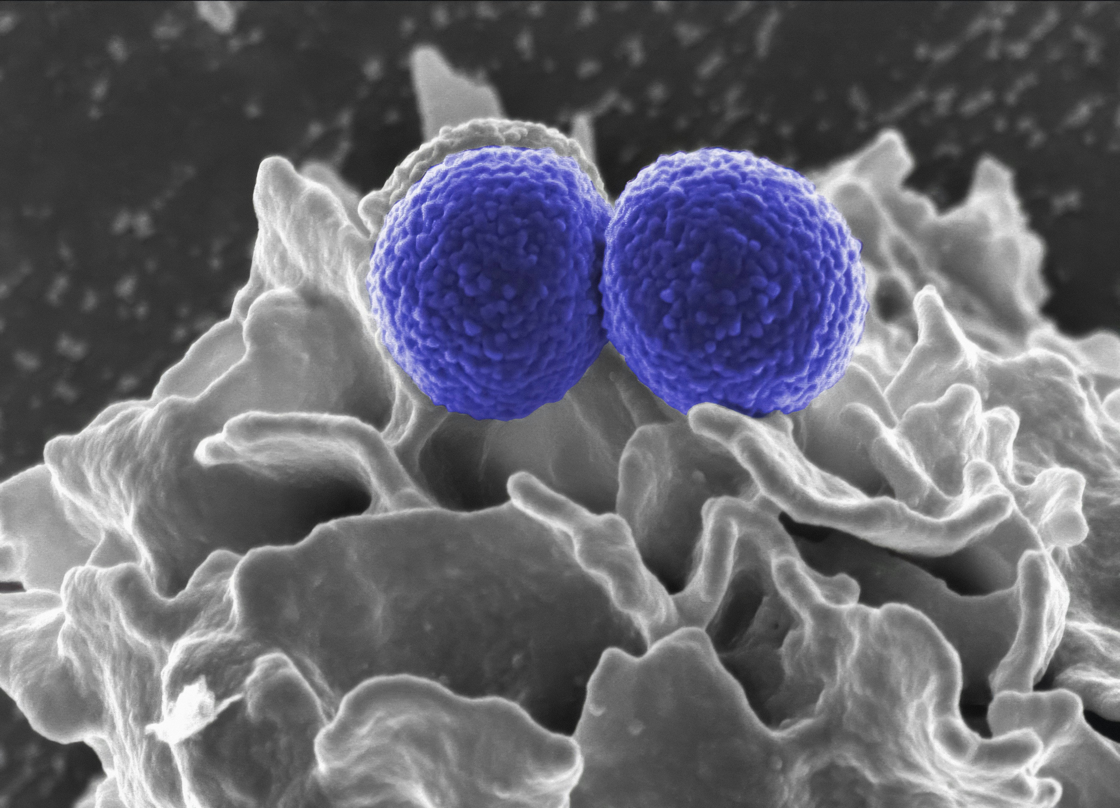 Entrega mejorada de CRISPR-Cas dirigida al genoma microbiano mediante la fusión de nanopartículas lipídicas
