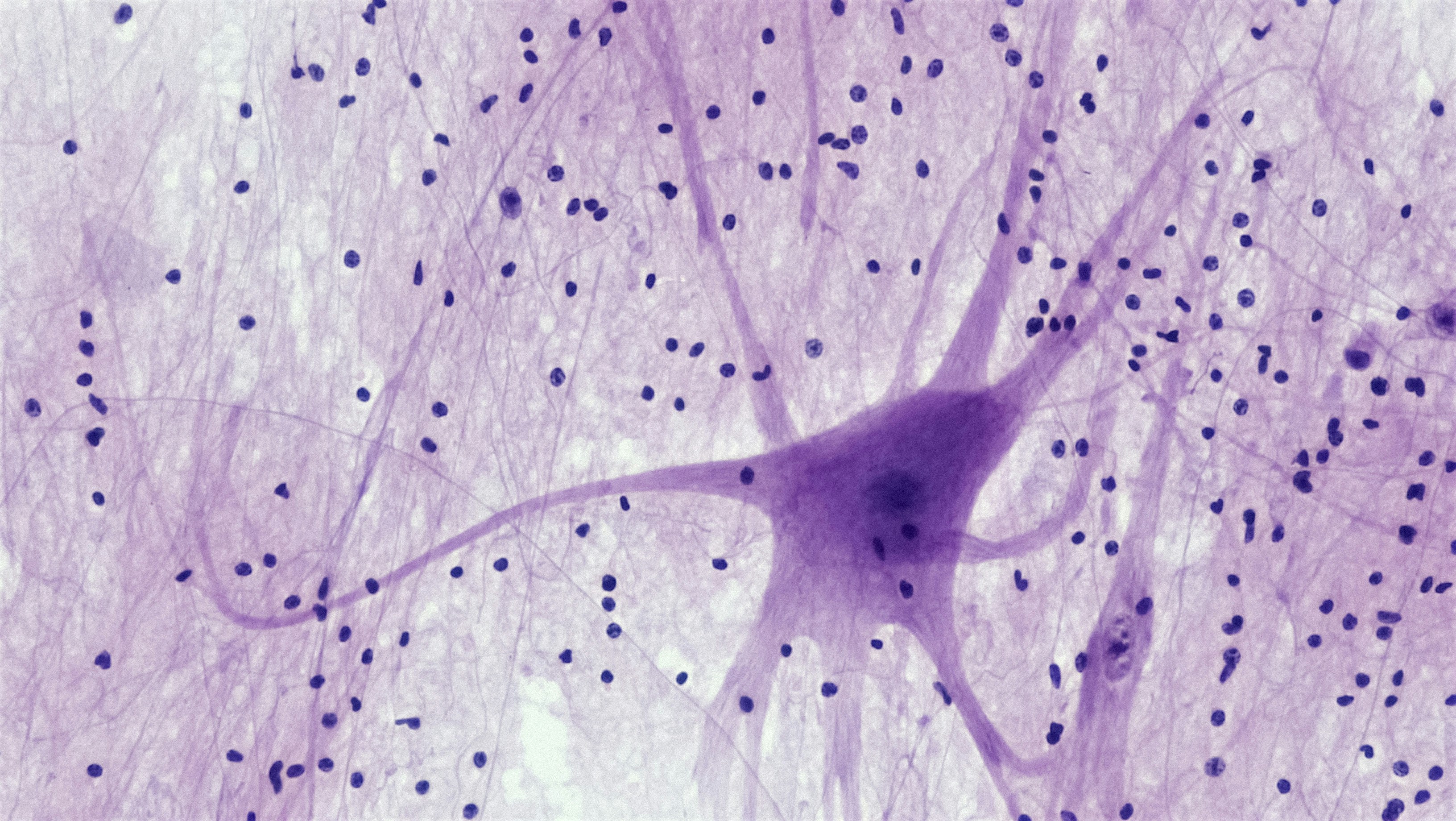 Redes neuronales informadas por la física mejoradas con pseudo-diferenciales