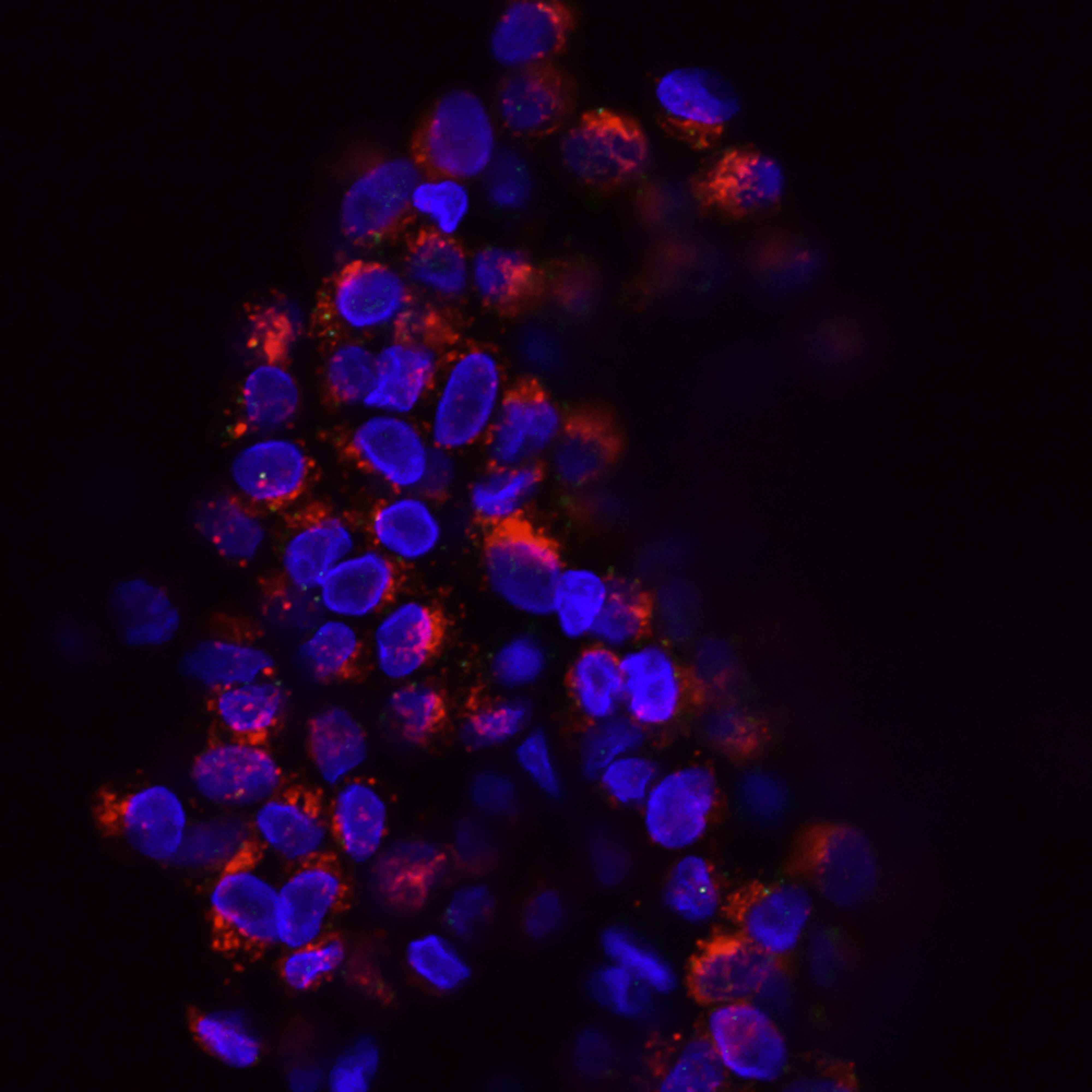 Entrega de conjugados de anticuerpos dirigidos para la regeneración de axones en reparación