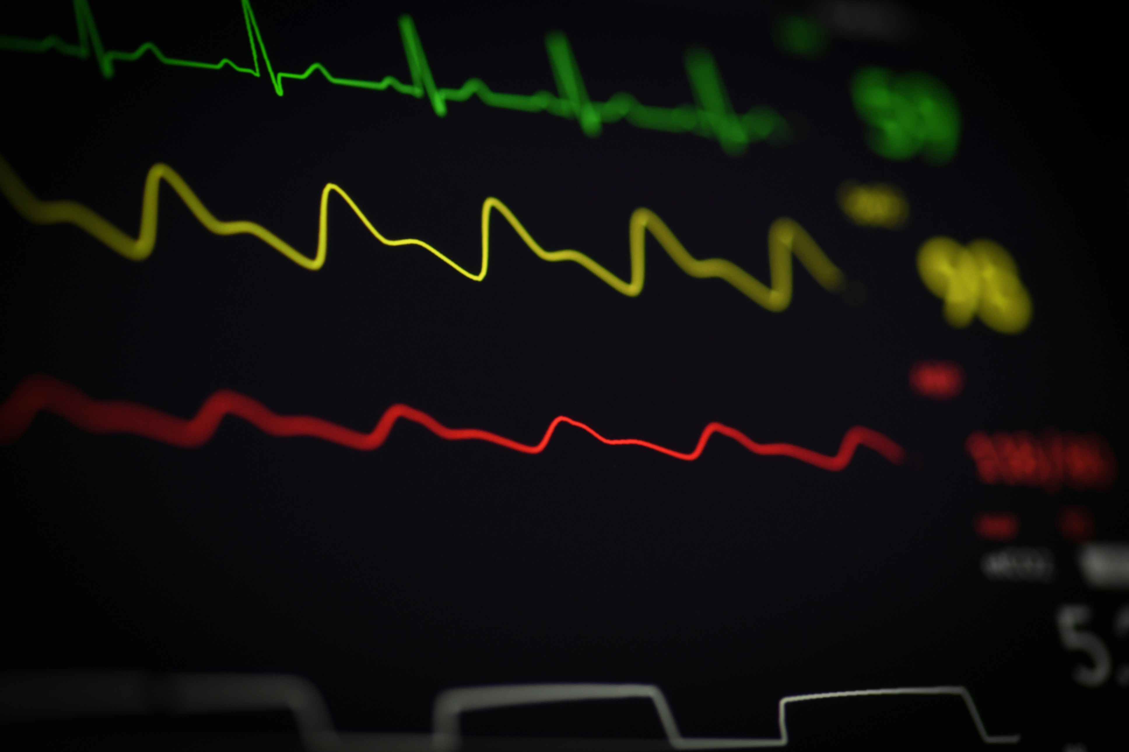 Aprendiendo representaciones latentes cardíacas en el espacio del vectorcardiograma