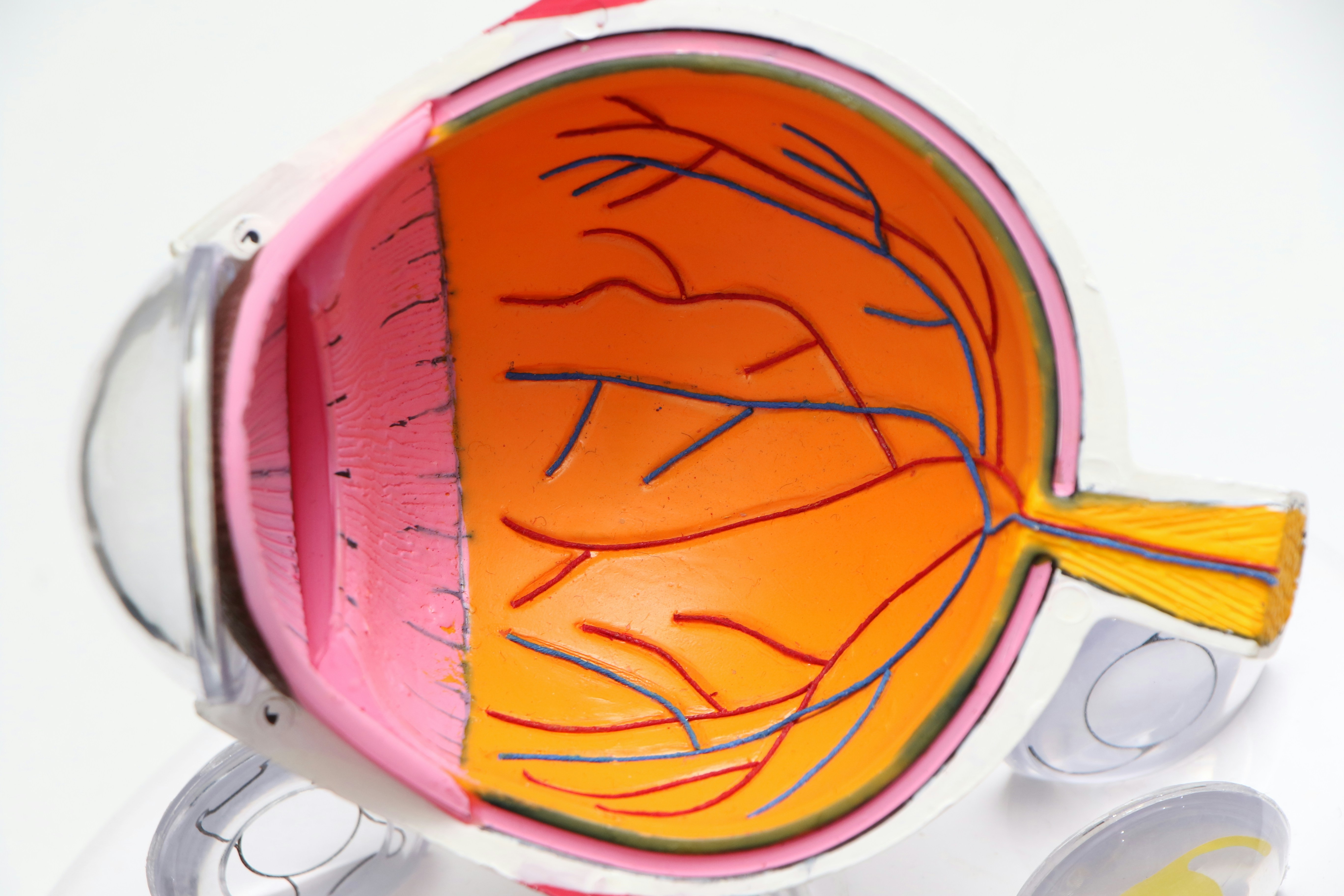 Retina-RAG: Modelado de Visión-Lenguaje Mejorado por Recuperación para Diagnóstico Retinal Conjunto y Generación de Informes Clínicos