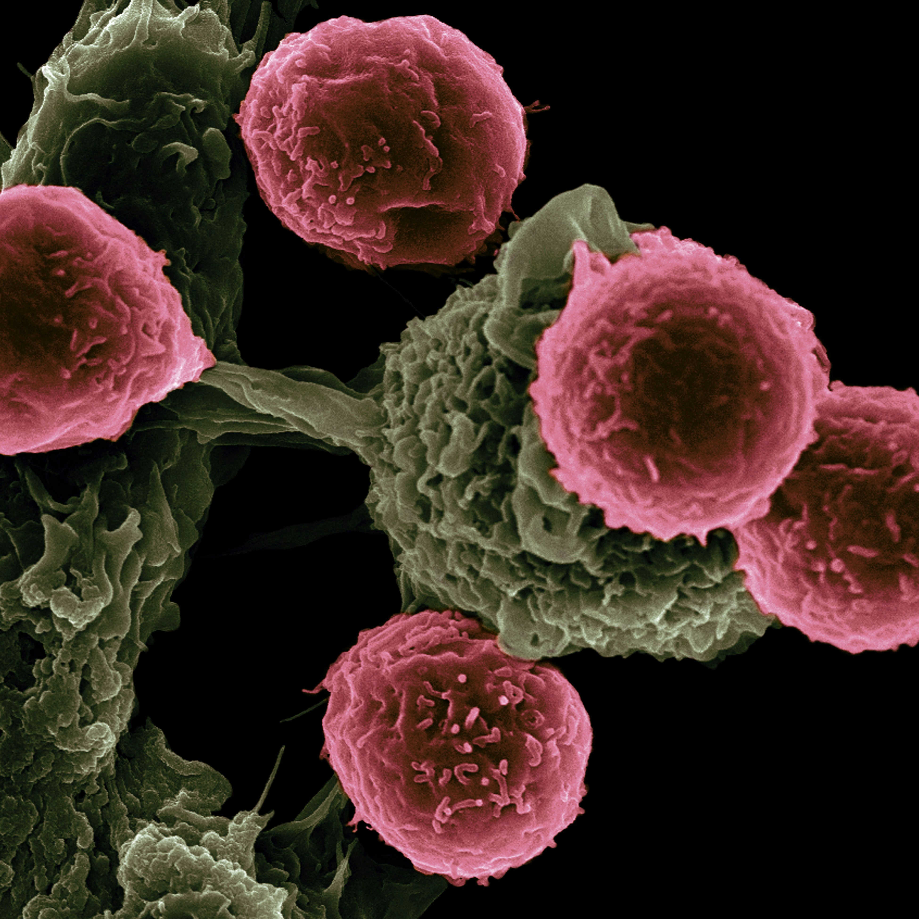 Revolucionando el cáncer: RevMed y la inhibición de RAS