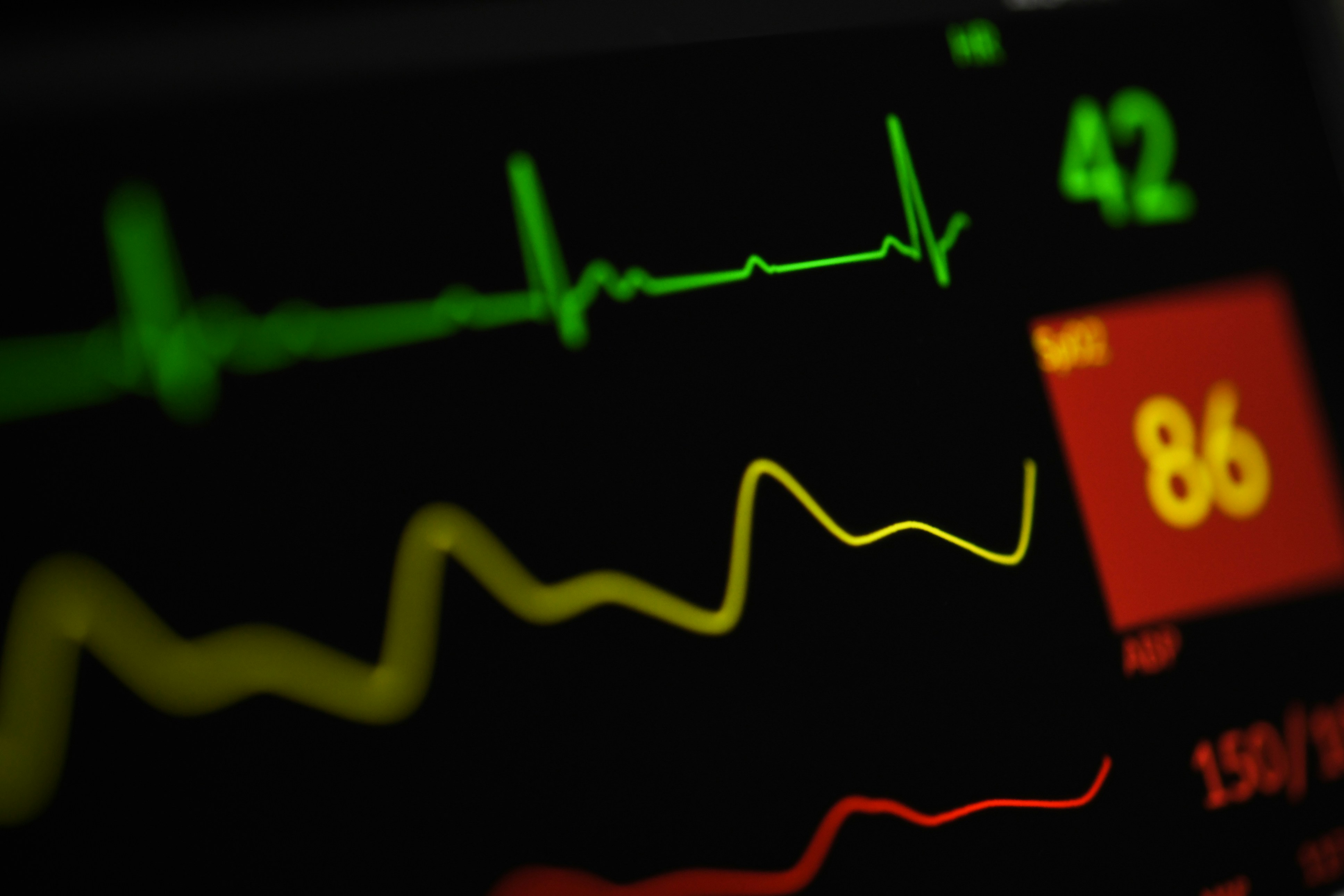 El ruido de medición limita la ventaja de modelos no lineales en biomedicina