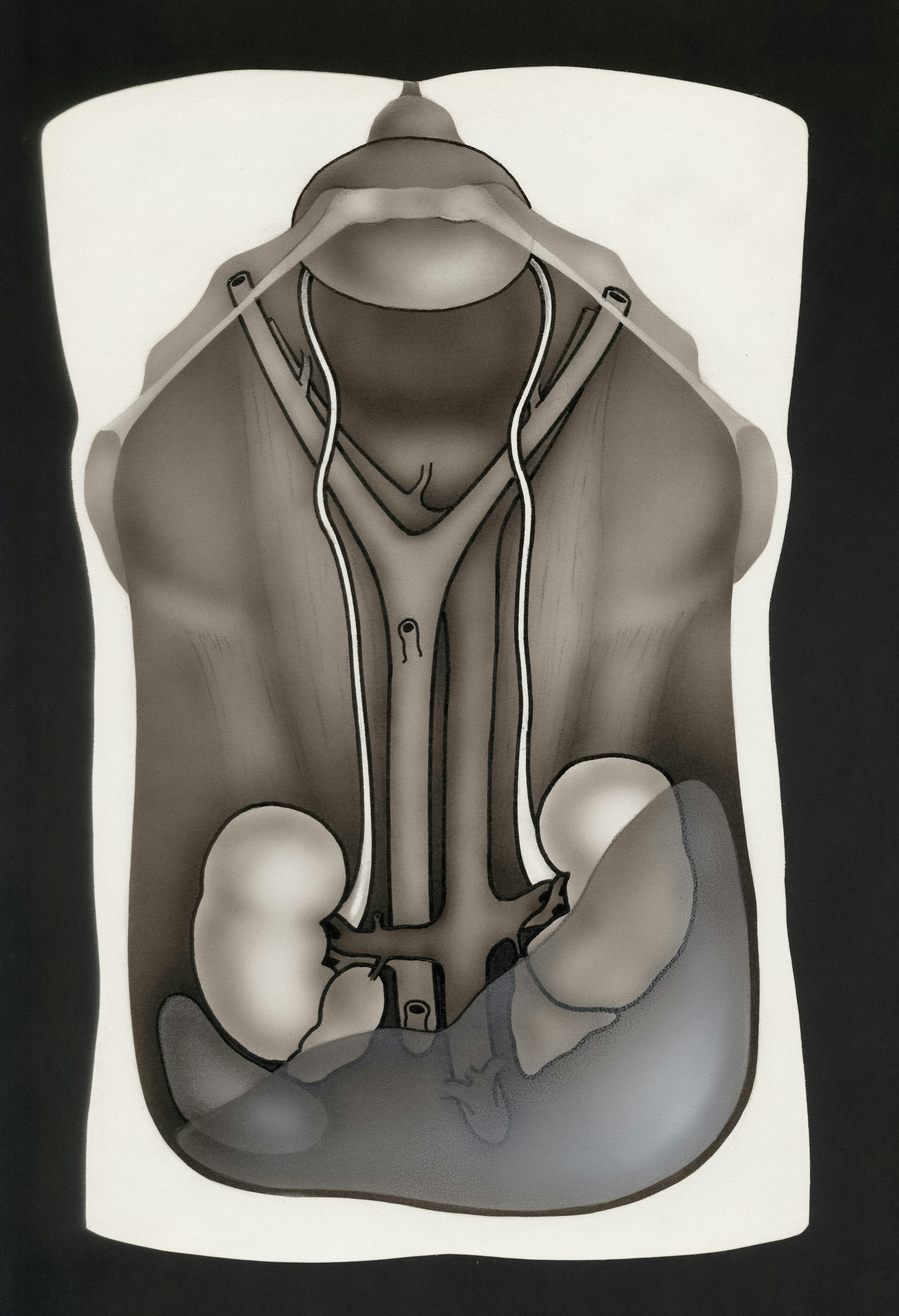 Segmentación 2D-U-Net multiplano de órganos abdominales con mapas de ocurrencia